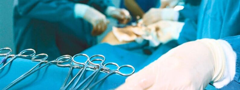 Bir cerrah tarafından gerçekleştirilen penis büyütme ameliyatı